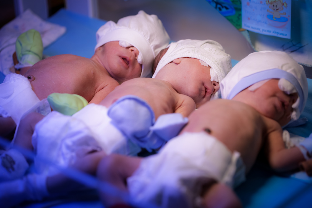 Newborn triplets baby are under the device with ultraviolet radiation in the maternity hospital