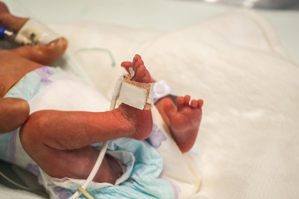 baby that was born with fetal distress