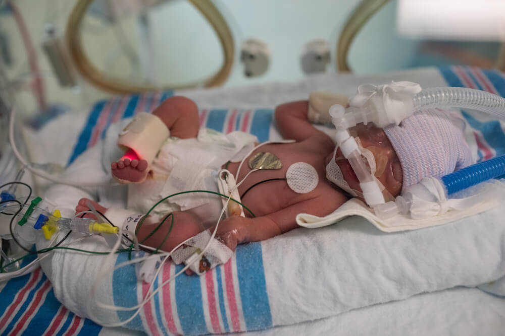 baby in the nicu